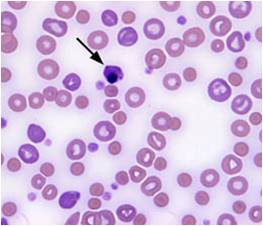 blood